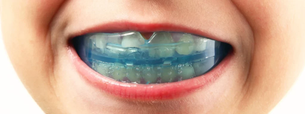 Éducation Fonctionnelle